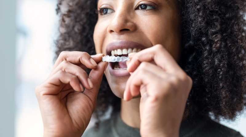 Aligners: Tips for Comfort and Smooth Adjustment